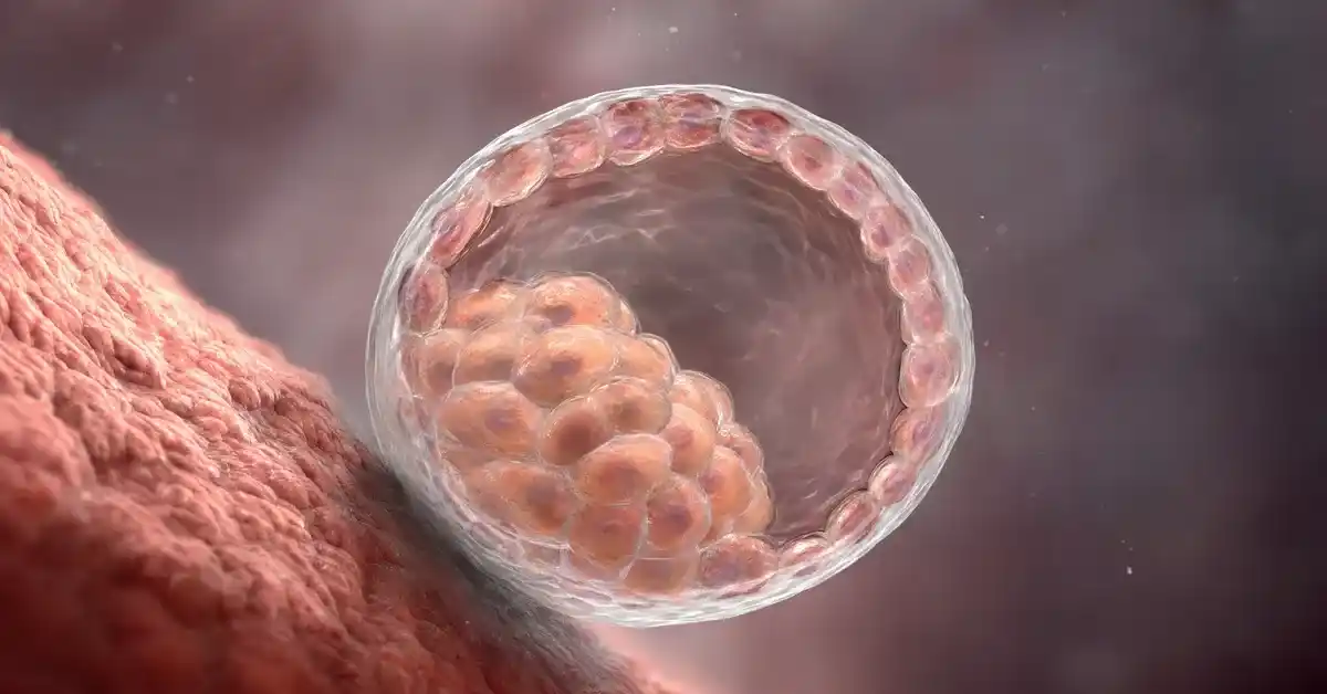 IVF Cost and Success: Turkey vs USA
