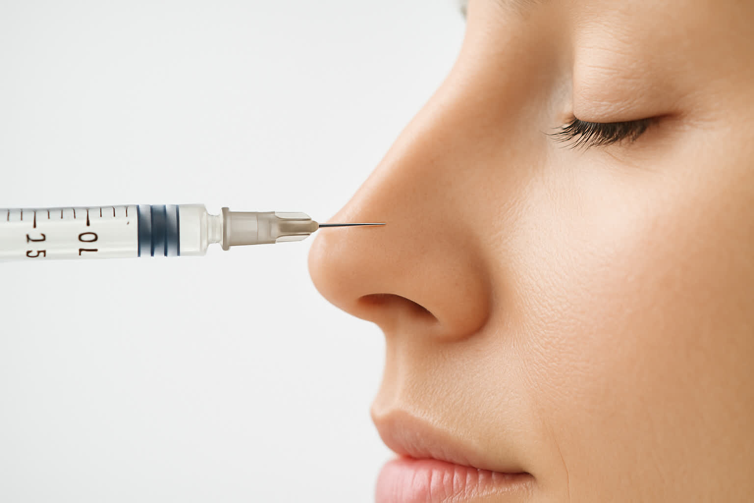 Non-Surgical Rhinoplasty with Filler: Natural and Quick Results