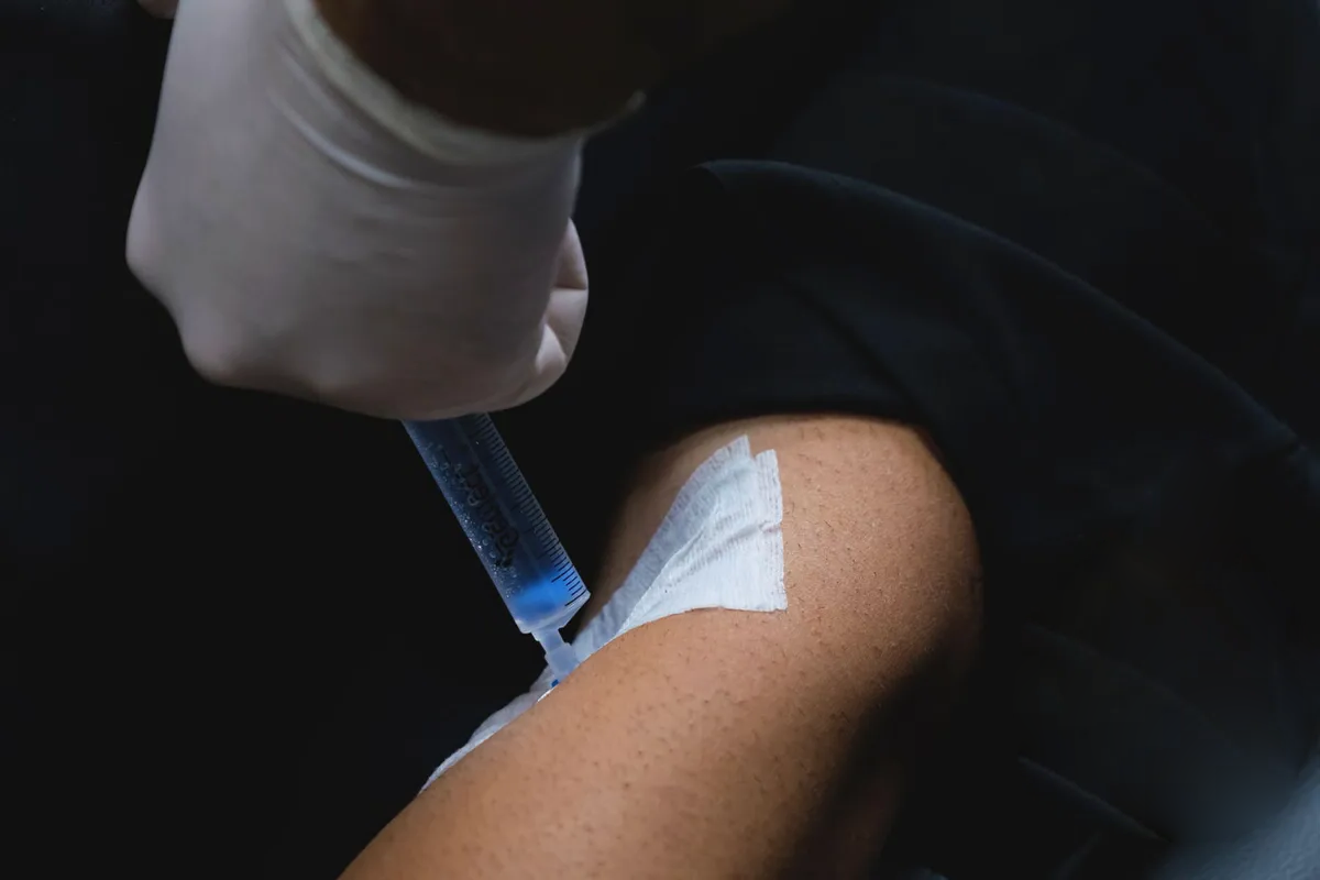 Enhancing Patient Comfort: The Role of Sedation in Hair Transplant Procedures