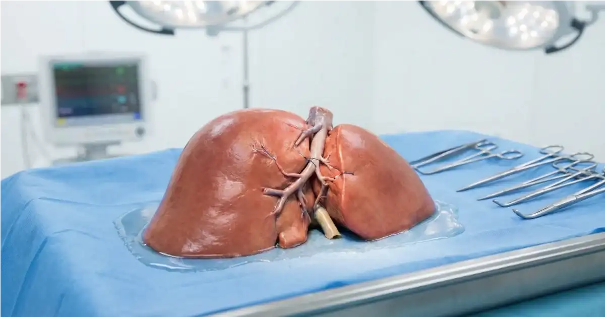 Living Donor Liver Transplant (LDLT)